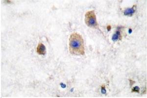 Image no. 2 for anti-Ephrin B3 (EFNB3) antibody (ABIN265403) (Ephrin B3 抗体)