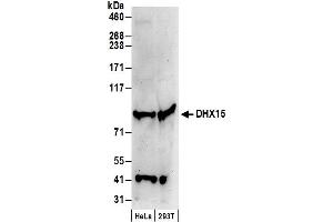 anti-DEAH (Asp-Glu-Ala-His) Box Polypeptide 15 (DHX15) (C-Term) antibody