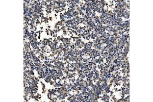 IHC analysis of CDC27 using anti-CDC27 antibody (ABIN7602163).