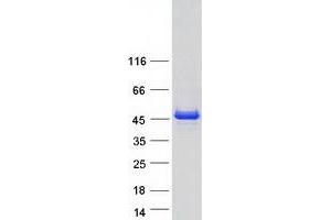 Western Blotting (WB) image for Mitogen-Activated Protein Kinase-Activated Protein Kinase 2 (MAPKAPK2) (Transcript Variant 2) protein (Myc-DYKDDDDK Tag) (ABIN2725452)