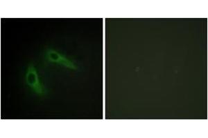 Immunofluorescence analysis of HeLa cells, using KCIP1 Antibody.