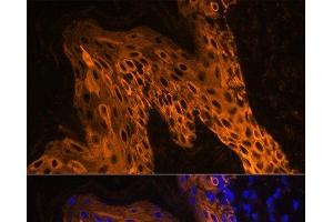 Immunofluorescence (IF) image for anti-Keratin 14 (KRT14) antibody (ABIN7258338)
