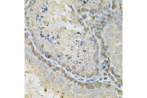 Immunohistochemistry of paraffin-embedded mouse testis using BUB1 Antibody (ABIN5970993) at dilution of 1/200 (40x lens). (BUB1 抗体)