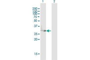 Western Blotting (WB) image for anti-Complement C1q Tumor Necrosis Factor-Related Protein 6 (C1QTNF6) (AA 1-278) antibody (ABIN2565389)