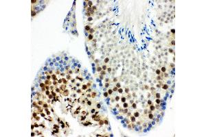 Anti- MCAK antibody, IHC(P) IHC(P): Mouse Testis Tissue (KIF2C 抗体  (AA 531-725))