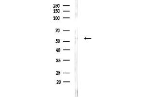 anti-Immunoresponsive Gene 1 (IRG1) (C-Term) antibody