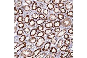 Immunohistochemical staining of human kidney with C19orf40 polyclonal antibody  shows strong cytoplasmic positivity in renal tubules. (C19orf24 抗体)