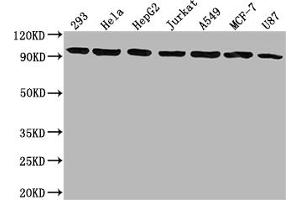 Western Blot Positive WB detected in: 293 whole cell lysate, Hela whole cell lysate, HepG2 whole cell lysate, Jurkat whole cell lysate, A549 whole cell lysate, MCF-7 whole cell lysate, U87 whole cell lysate All lanes: NR3C1 antibody at 1:1500 Secondary Goat polyclonal to rabbit IgG at 1/50000 dilution Predicted band size: 86, 83, 82, 77, 76, 65, 61, 52, 51, 50 kDa Observed band size: 95 kDa (Recombinant Glucocorticoid Receptor 抗体)