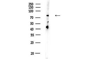 Western blot analysis of lysates from EC304 cells, using POL Antibody at 1/1000 dilution.