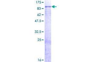 DCP1A Protein (AA 1-582) (GST tag)