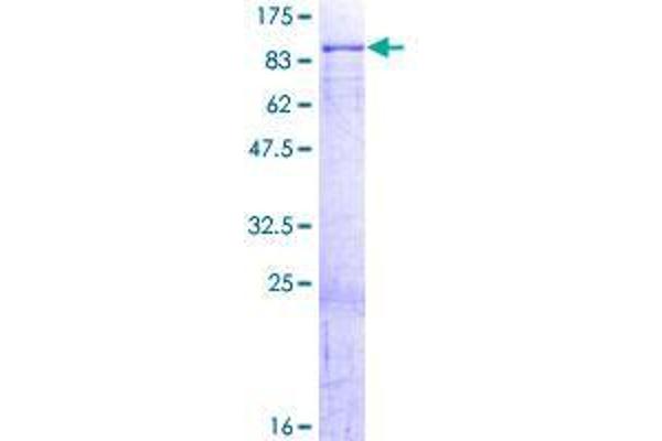 DCP1A Protein (AA 1-582) (GST tag)
