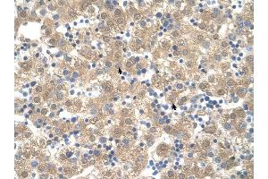 PPIB antibody was used for immunohistochemistry at a concentration of 4-8 ug/ml to stain Hepatocytes (arrows) in Human Liver. (PPIB 抗体)
