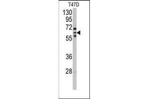 Image no. 1 for anti-Cytochrome P450, Family 2, Subfamily C, Polypeptide 8 (CYP2C8) (N-Term) antibody (ABIN360416)
