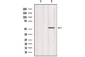 Western Blotting (WB) image for anti-Homocysteine-Inducible, Endoplasmic Reticulum Stress-Inducible, Ubiquitin-Like Domain Member 1 (HERPUD1) (N-Term) antibody (ABIN6262218)