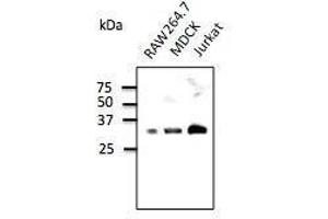 Anti-Rab35 Ab at 1/500 dilution, 293HEK transfected With GFP-Rab35, tysates at 100 µg per Iane, rabbit polyclonal to goat lµg (HRP) at 1/10,000 dilution, (RAB9B 抗体  (C-Term))
