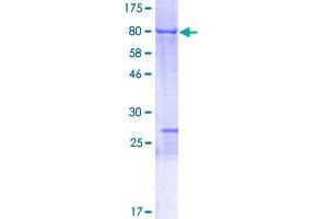 NOSTRIN Protein (AA 1-506) (GST tag)