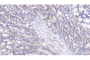 Detection of SOD3 in Human Small intestine Tissue using Monoclonal Antibody to Superoxide Dismutase 3, Extracellular (SOD3) (SOD3 抗体  (AA 19-240))