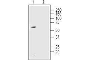 Western blot analysis of rat colon lysate: - 1. (GLP2R 抗体  (1st Extracellular Loop))