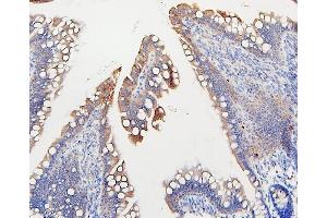 IHC analysis of IFNAR2 using anti-IFNAR2 antibody (ABIN7601353).