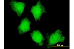 Immunofluorescence (IF) image for anti-Calcium/calmodulin-Dependent Protein Kinase II alpha (CAMK2A) (AA 305-410) antibody (ABIN513973)