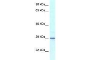 Image no. 1 for anti-Kv Channel Interacting Protein 3, Calsenilin (KCNIP3) (AA 30-79) antibody (ABIN6747422) (DREAM 抗体  (AA 30-79))
