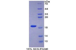 SDS-PAGE analysis of Mouse COL2A1 Protein. (COL2A1 蛋白)