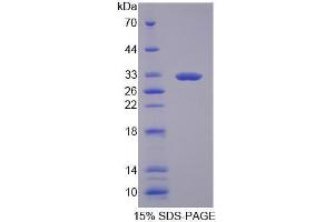 Image no. 1 for Guanylate Binding Protein 3 (GBP3) (AA 35-276) protein (His tag) (ABIN5665239) (GBP3 Protein (AA 35-276) (His tag))