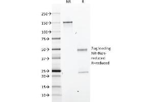 SDS-PAGE (SDS) image for anti-Glial Fibrillary Acidic Protein (GFAP) antibody (ABIN6939502)