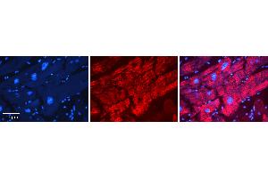 Rabbit Anti-AGPAT2 Antibody Catalog Number: ARP44636_P050 Formalin Fixed Paraffin Embedded Tissue: Human heart Tissue Observed Staining: Cytoplasmic Primary Antibody Concentration: N/A Other Working Concentrations: 1:600 Secondary Antibody: Donkey anti-Rabbit-Cy3 Secondary Antibody Concentration: 1:200 Magnification: 20X Exposure Time: 0. (AGPAT2 抗体  (C-Term))