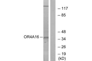 Western blot analysis of extracts from COLO cells, using OR4A16 antibody. (OR4A16 抗体  (C-Term))