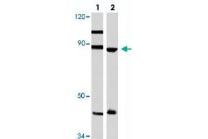 Western blot analysis of Hela (lane 1) and A-549 (lane 2) cell lysate with TPX2 polyclonal antibody . (TPX2 抗体)