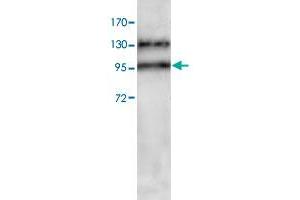 Western blot analysis of HeLa cell lysate with ADAM17 polyclonal antibody  at 1 : 200 dilution. (ADAM17 抗体  (C-Term))