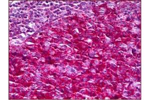 Human Tonsil: Formalin-Fixed, Paraffin-Embedded (FFPE)