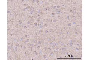 IHC analysis of PTN using anti-PTN antibody (ABIN7602164). (Pleiotrophin 抗体  (AA 61-148))