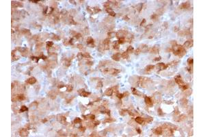 Immunohistochemistry (IHC) image for anti-V-type immunoglobulin domain-containing suppressor of T-cell activation (VISTA) antibody (ABIN6940575)