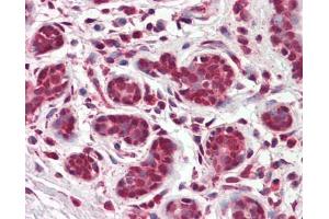 Image no. 1 for anti-Thyroid Hormone Receptor, beta (THRB) (AA 1-169) antibody (ABIN467595) (THRB 抗体  (AA 1-169))