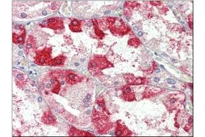 Kidney, Human: Formalin-Fixed, Paraffin-Embedded (FFPE) (Clathrin Heavy Chain (CLTC) (Heavy Chain) 抗体)
