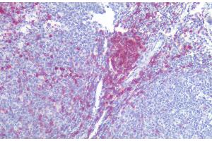 Immunohistochemistry staining of human tonsil (paraffin-embedded sections) with anti-CD5 (L17F12), 10 μg/mL. (CD5 抗体)