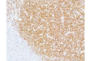 Immunohistochemistry (IHC) image for anti-CD19 Molecule (CD19) (AA 21-291) antibody (ABIN7449425) (Recombinant CD19 抗体  (AA 21-291))
