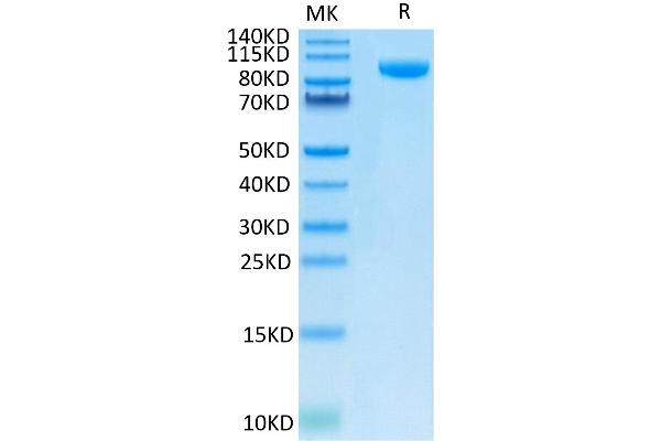 CD276 Protein (CD276) (AA 27-461) (Fc Tag)