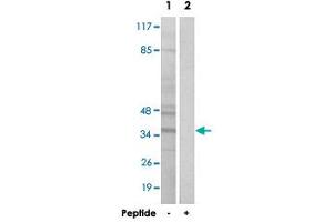 Western blot analysis of extracts from Jurkat cells, using BNIP2 polyclonal antibody . (BNIP2 抗体  (C-Term))