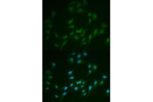 Immunofluorescence analysis of MCF-7 cells using LIG1 antibody. (LIG1 抗体  (AA 565-790))