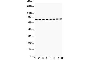 Western blot testing of BRAF antibody and Lane 1:  rat testis tissue (BRAF 抗体  (AA 38-230))