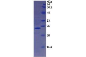 SDS-PAGE analysis of Sheep Hemoglobin beta Protein. (Hemoglobin Subunit beta 蛋白)