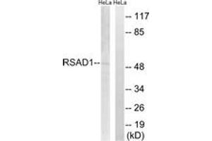 Western blot analysis of extracts from HeLa cells, using RSAD1 Antibody. (RSAD1 抗体  (AA 298-347))