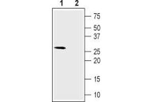 Western blot analysis of rat skeletal muscle lysate: - 1. (CACNG6 抗体  (1st Extracellular Loop))
