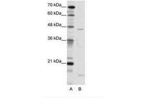 Image no. 1 for anti-Thyroid Hormone Receptor Interactor 13 (TRIP13) (C-Term) antibody (ABIN202512) (TRIP13 抗体  (C-Term))