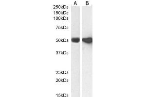 Western Blotting (WB) image for anti-Glial Fibrillary Acidic Protein (GFAP) (C-Term) antibody (ABIN185730)