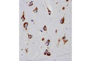 Immunohistochemical staining of paraffin-embedded human brain section reacted with RPS6 monoclonal antibody  at 1:25 dilution. (RPS6 抗体)
