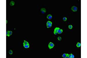 Immunofluorescent analysis of MCF-7 cells using ABIN7169819 at dilution of 1:100 and Alexa Fluor 488-congugated AffiniPure Goat Anti-Rabbit IgG(H+L) (SLIT-ROBO rho GTPase Activating Protein 2B (SRGAP2B) (AA 79-150) 抗体)